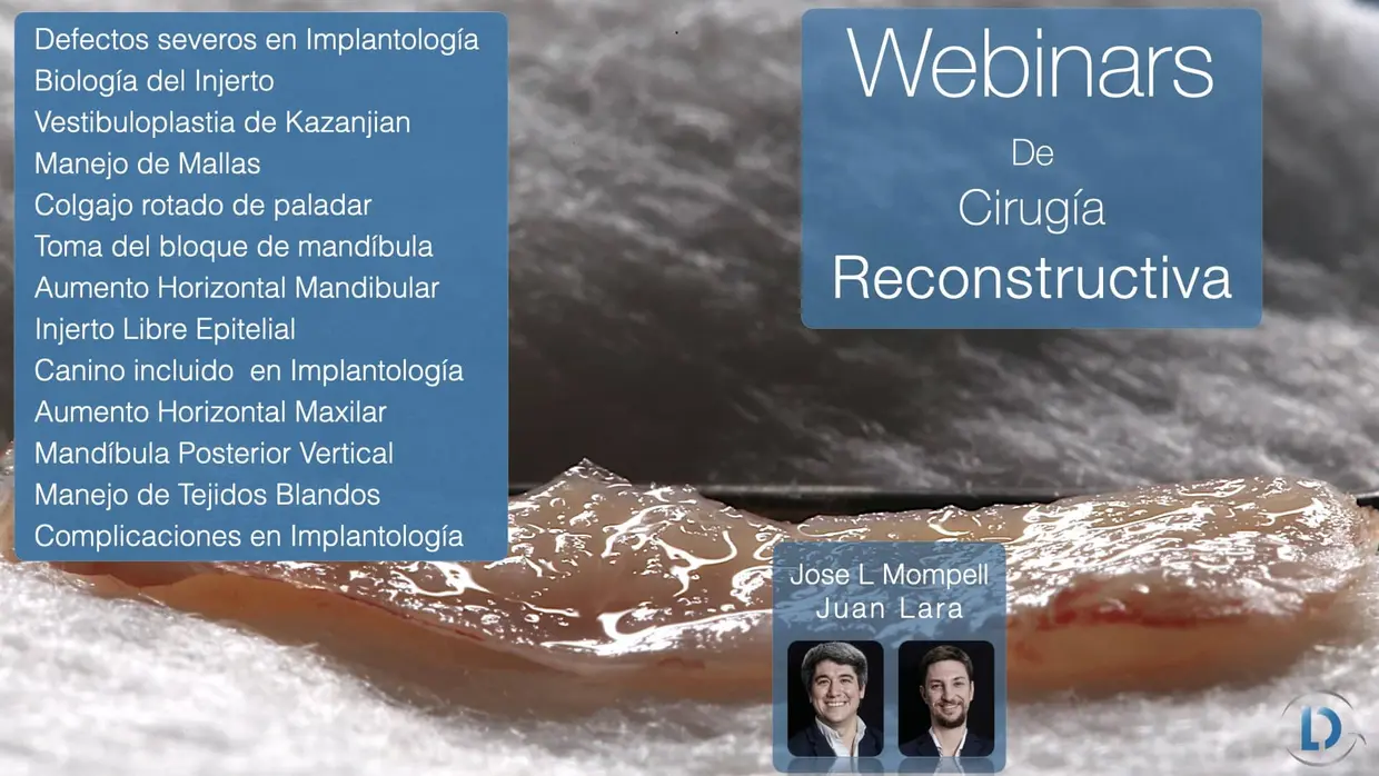 webinars en cirugía oral e implantología