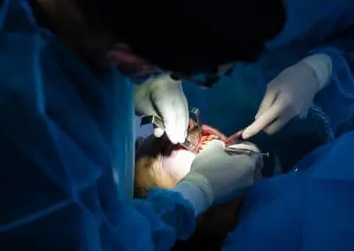 curso de implantes dentales en pacientes