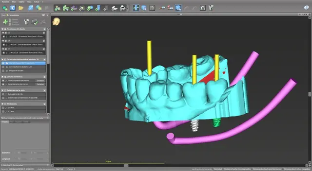 flujo digital odontología