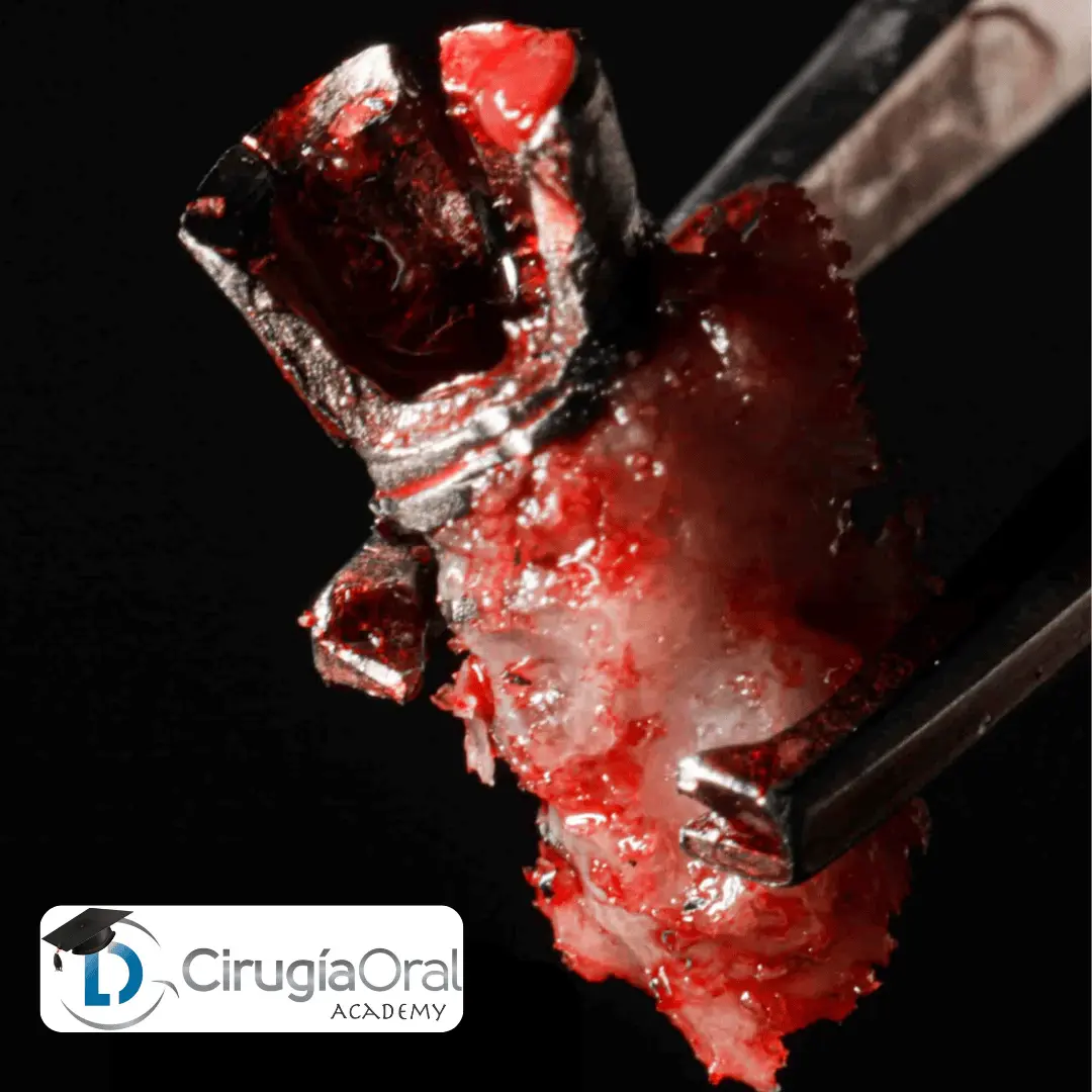 cursos de implantología y cirugía oral