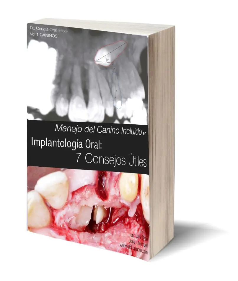 Portada del libro Manejo del Canino Incluido en Implantología Oral: 7 Consejos Útiles<br />
