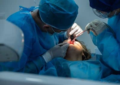 curso de implantes dentales en pacientes
